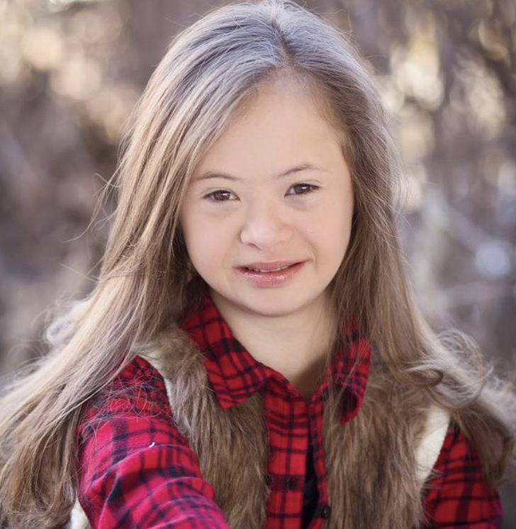 Model's Unusual History With Down Syndrome Kennedy Garcia