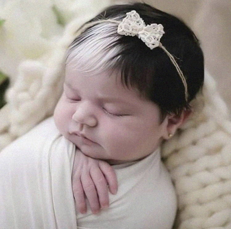 This little atypical with white hair is already three years old. What does she look like now?