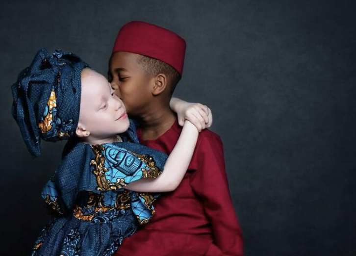 Une femme a donné naissance à des jumeaux noirs et blancs