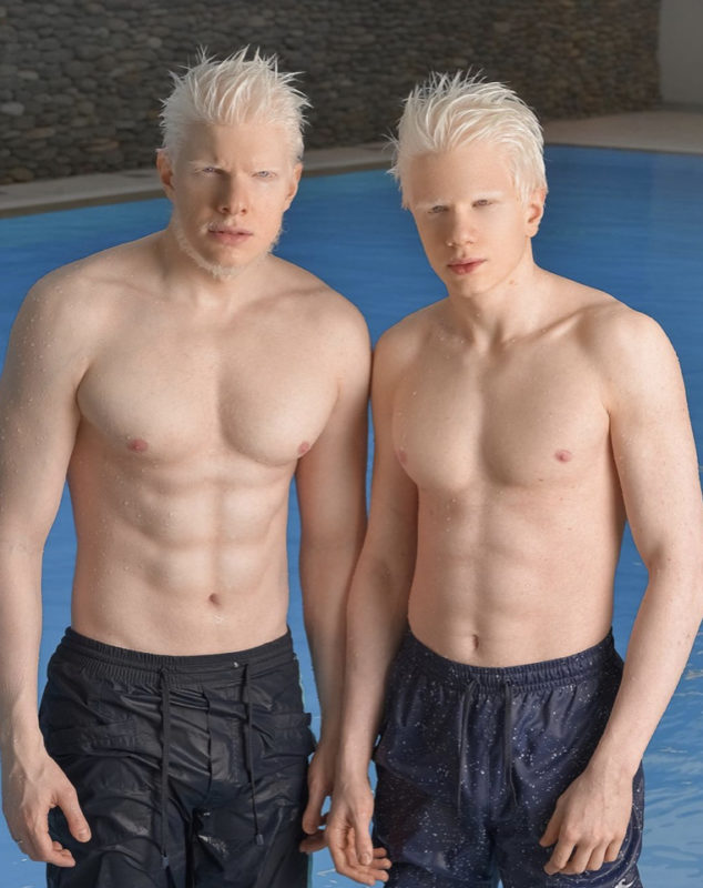 An albino boy turned his flaws into advantages