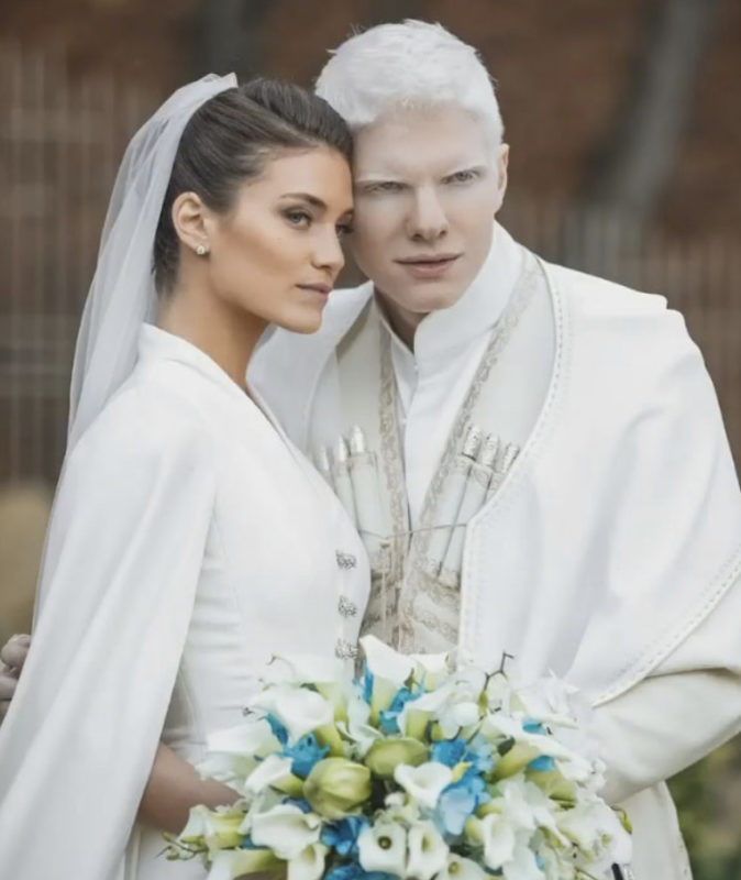 An albino boy turned his flaws into advantages