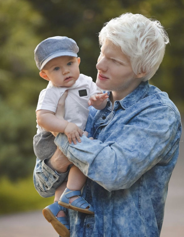 An albino boy turned his flaws into advantages