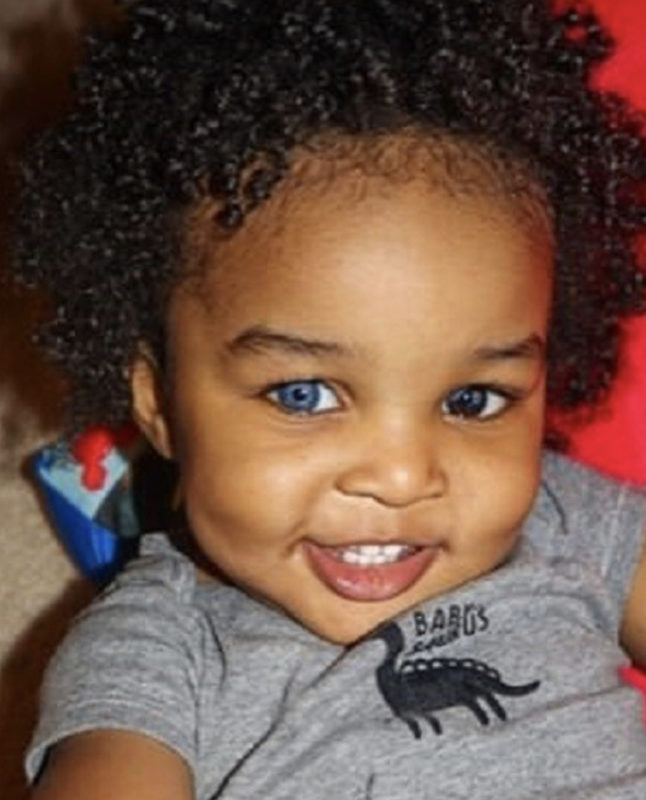 Elizabeth, 35, and her son have unusual eyes: half black, half blue